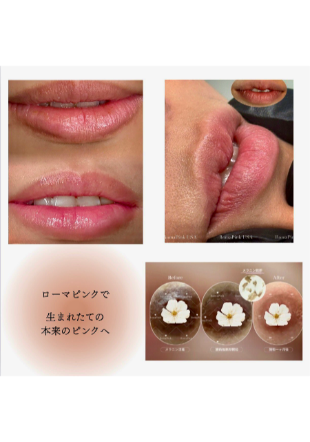 ローマピンク紹介画像.02