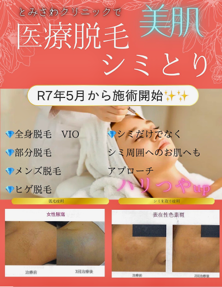医療脱毛_フォトフェイシャル_紹介画像.01